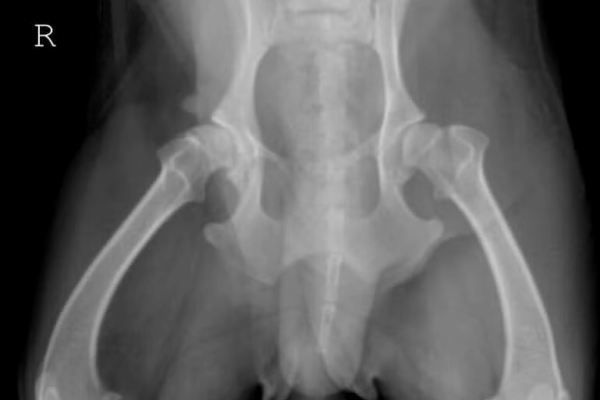 Dysplastic-Bilateral-OFA-Hips (1)