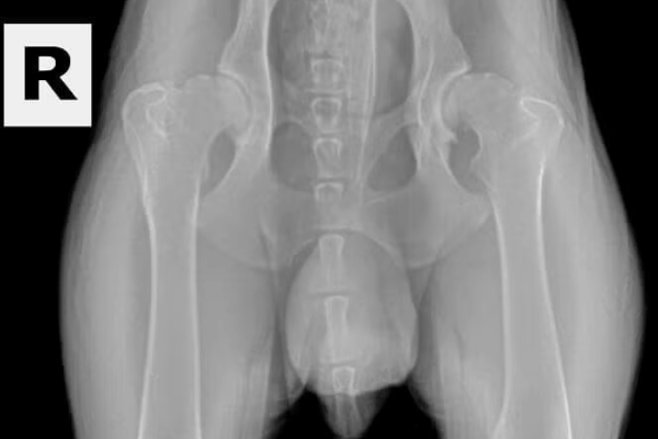 Dysplastic-OFA-Hips (1)