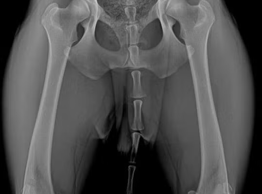 Fair-Hips (1)