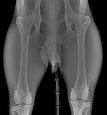 Mild-Dysplastic-Hips (1)